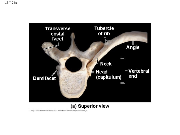 LE 7 -24 a Transverse costal facet Tubercle of rib Angle Neck Demifacet Head LE 7 -24 a Transverse costal facet Tubercle of rib Angle Neck Demifacet Head
