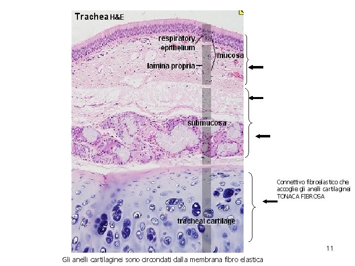Connettivo fibroelastico che accoglie gli anelli cartilaginei TONACA FIBROSA 11 Gli anelli cartilaginei sono Connettivo fibroelastico che accoglie gli anelli cartilaginei TONACA FIBROSA 11 Gli anelli cartilaginei sono