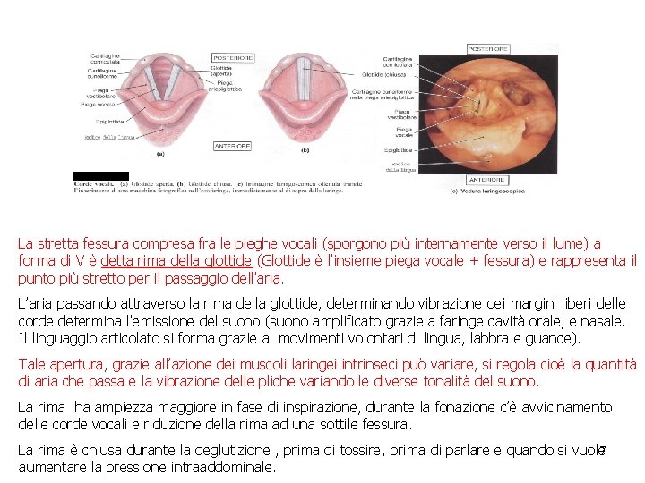 La stretta fessura compresa fra le pieghe vocali (sporgono più internamente verso il lume) La stretta fessura compresa fra le pieghe vocali (sporgono più internamente verso il lume)
