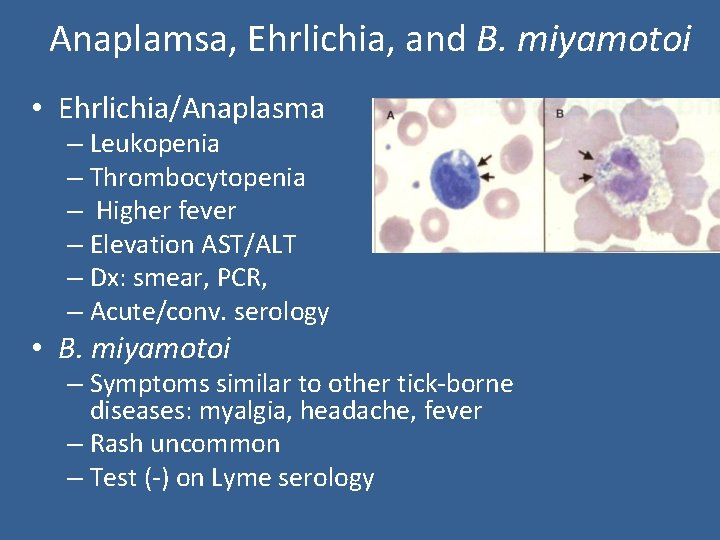 Anaplamsa, Ehrlichia, and B. miyamotoi • Ehrlichia/Anaplasma – Leukopenia – Thrombocytopenia – Higher fever