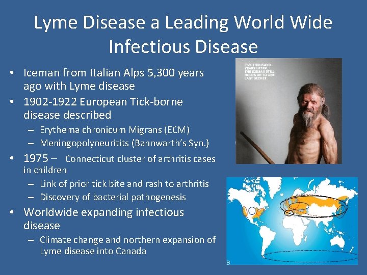 Lyme Disease a Leading World Wide Infectious Disease • Iceman from Italian Alps 5,