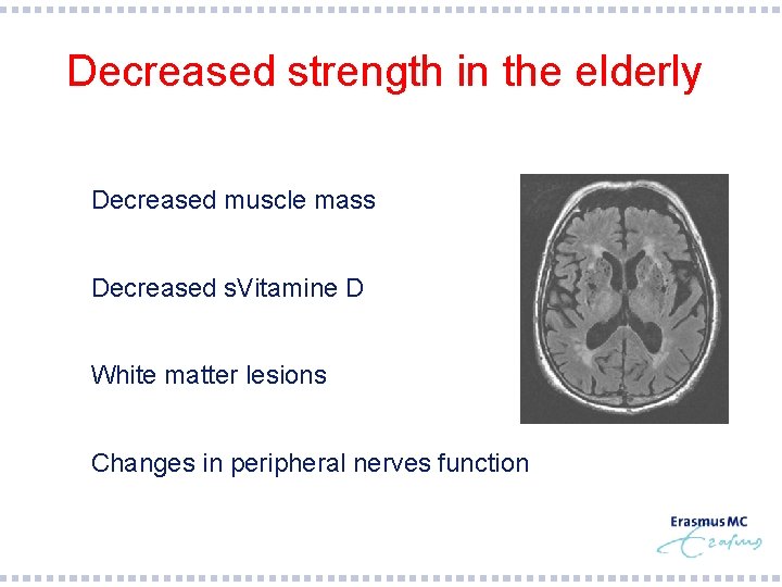 Decreased strength in the elderly § Decreased muscle mass § Decreased s. Vitamine D