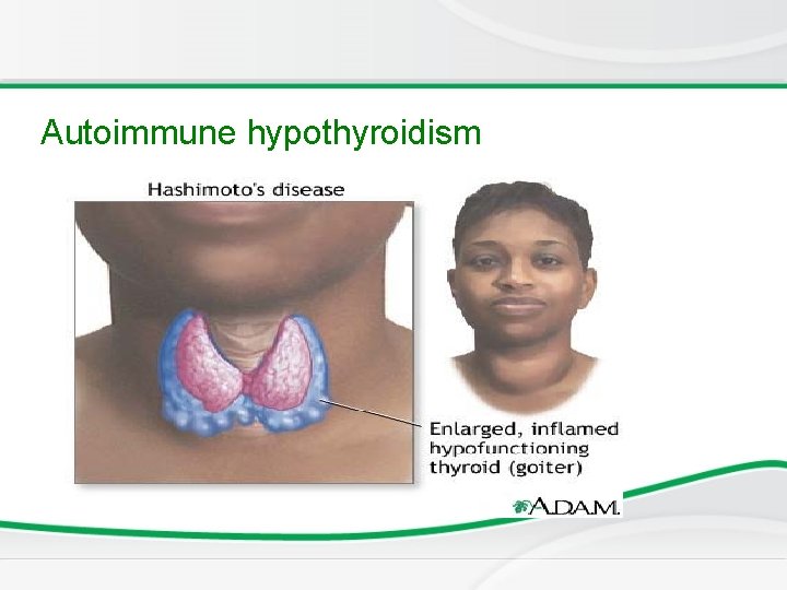 Common Thyroid Disorders in Children FUNCTIONS OF THYROXINE