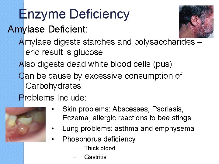 Enzyme Deficiency Amylase Deficient: Amylase digests starches and polysaccharides – end result is glucose