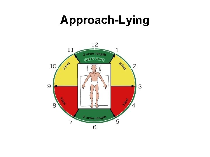Approach-Lying 
