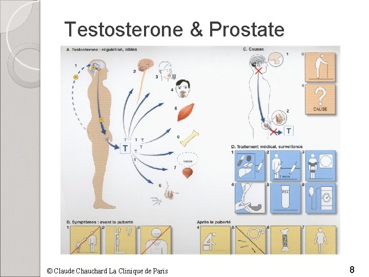 Testosterone & Prostate © Claude Chauchard La Clinique de Paris 8 