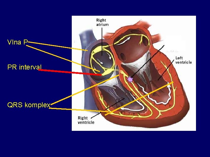 Vlna P PR interval QRS komplex b 