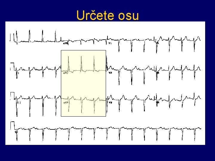 Určete osu 