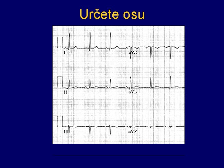 Určete osu 