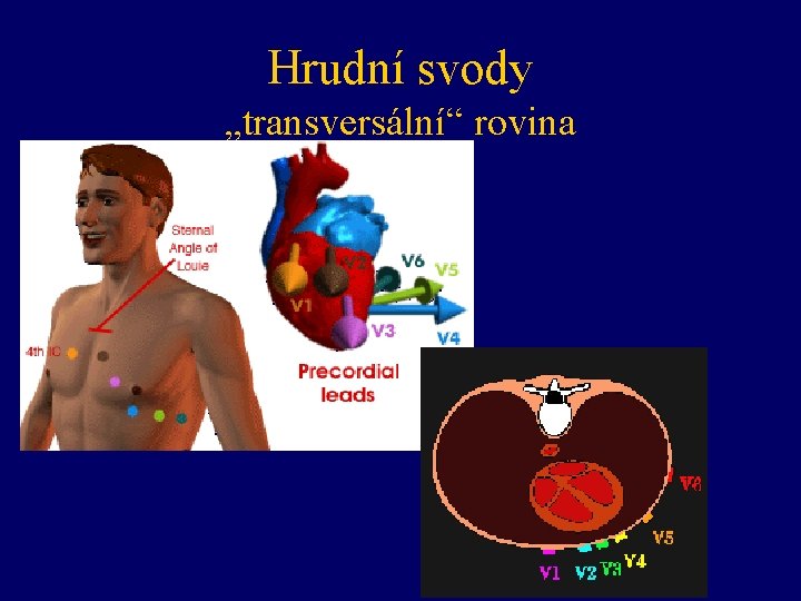 Hrudní svody „transversální“ rovina 