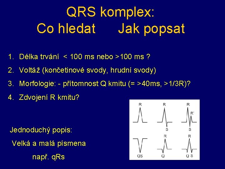 QRS komplex: Co hledat Jak popsat 1. Délka trvání < 100 ms nebo >100