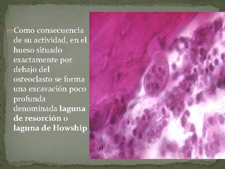 Como consecuencia de su actividad, en el hueso situado exactamente por debajo del Como consecuencia de su actividad, en el hueso situado exactamente por debajo del