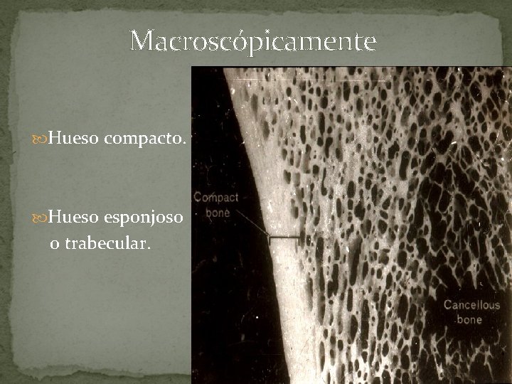 Macroscópicamente Hueso compacto. Hueso esponjoso o trabecular. Macroscópicamente Hueso compacto. Hueso esponjoso o trabecular.