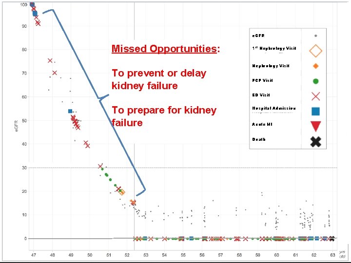 e. GFR Missed Opportunities: To prevent or delay kidney failure 1 st Nephrology Visit