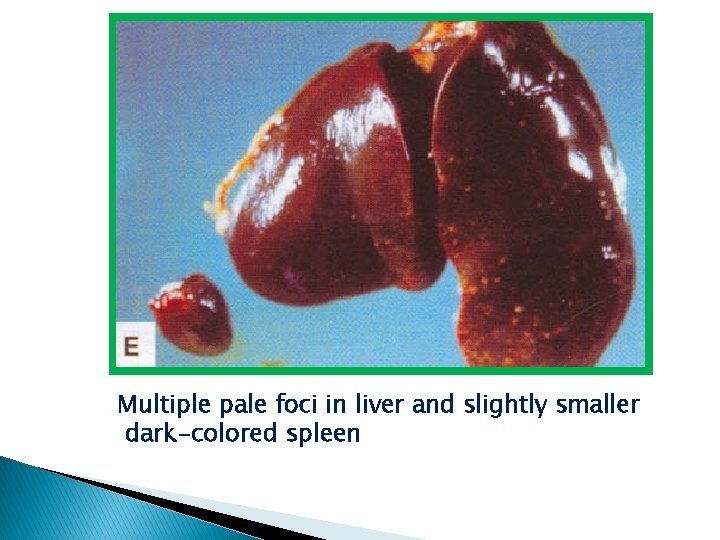 Multiple pale foci in liver and slightly smaller dark-colored spleen 