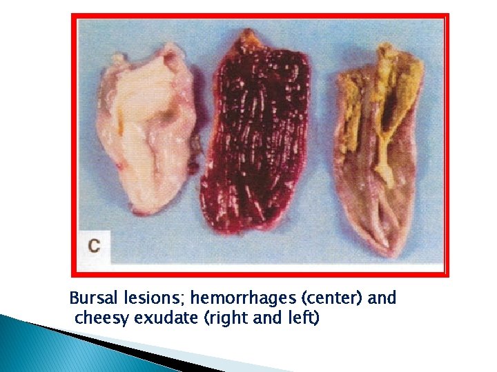 Bursal lesions; hemorrhages (center) and cheesy exudate (right and left) 