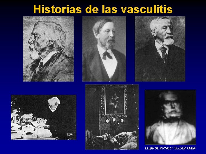 Historias de las vasculitis Efigie del profesor Rudolph Maier 