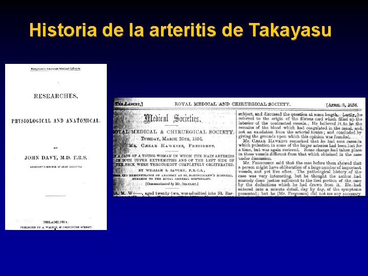 Historia de la arteritis de Takayasu 