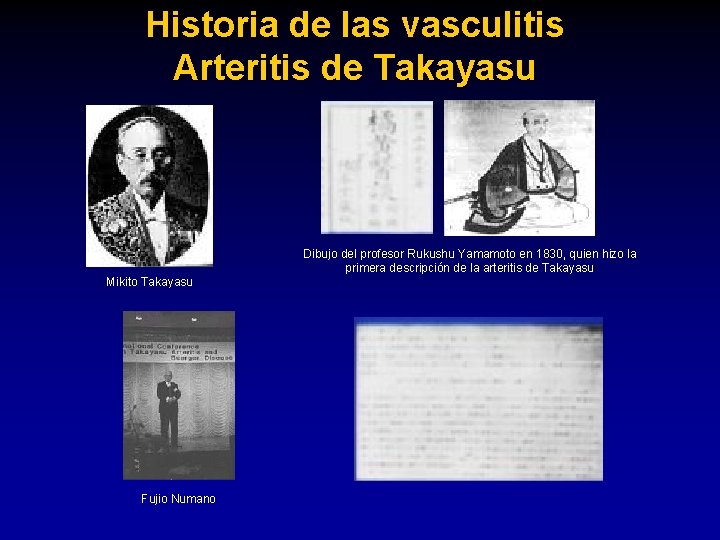 Historia de las vasculitis Arteritis de Takayasu Mikito Takayasu Fujio Numano Dibujo del profesor