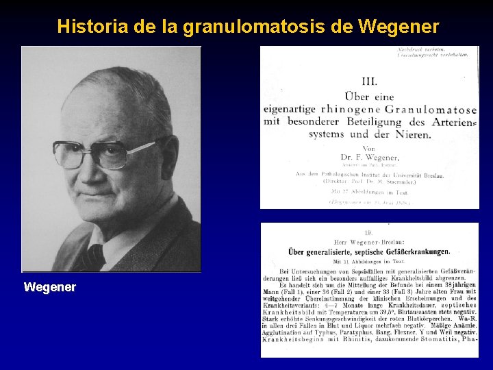 Historia de la granulomatosis de Wegener 