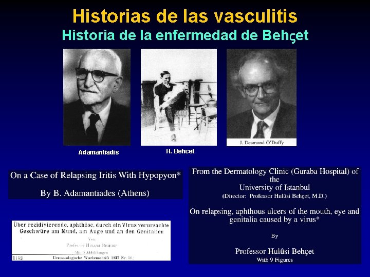 Historias de las vasculitis Historia de la enfermedad de Beh et Adamantiadis H. Behcet