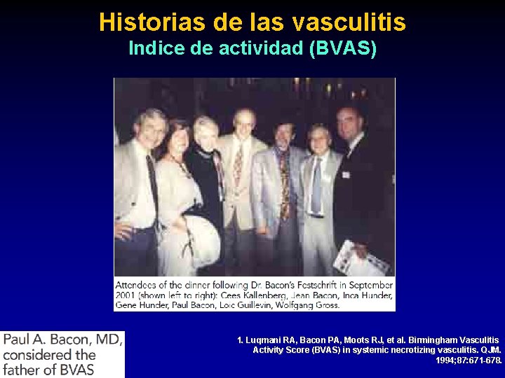 Historias de las vasculitis Indice de actividad (BVAS) 1. Luqmani RA, Bacon PA, Moots