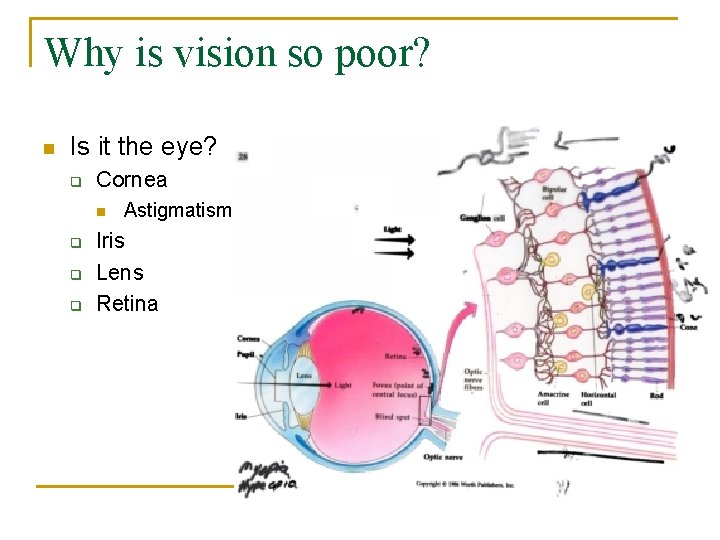 Why is vision so poor? n Is it the eye? q Cornea n q