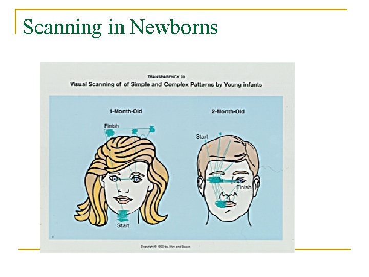 Scanning in Newborns 