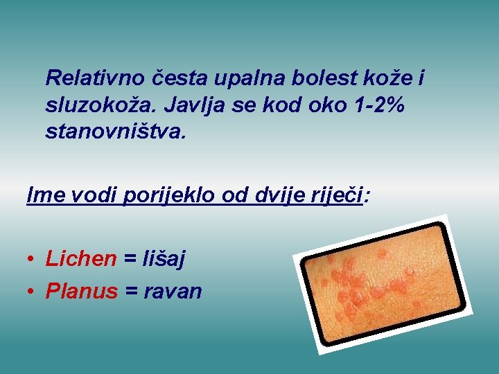 Relativno česta upalna bolest kože i sluzokoža. Javlja se kod oko 1 -2% stanovništva.