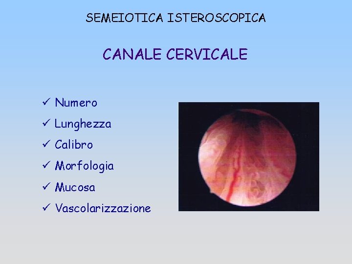 SEMEIOTICA ISTEROSCOPICA CANALE CERVICALE ü Numero ü Lunghezza ü Calibro ü Morfologia ü Mucosa