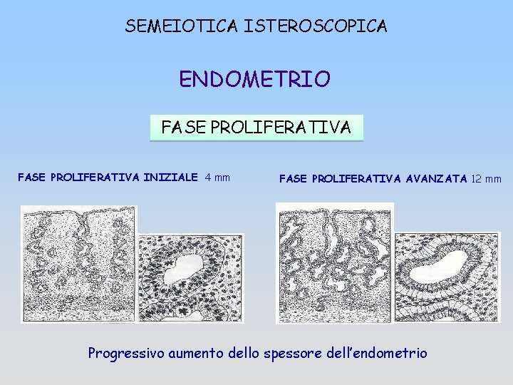 SEMEIOTICA ISTEROSCOPICA ENDOMETRIO FASE PROLIFERATIVA INIZIALE 4 mm FASE PROLIFERATIVA AVANZATA 12 mm Progressivo