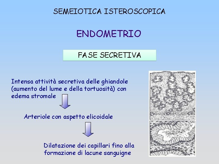 SEMEIOTICA ISTEROSCOPICA ENDOMETRIO FASE SECRETIVA Intensa attività secretiva delle ghiandole (aumento del lume e