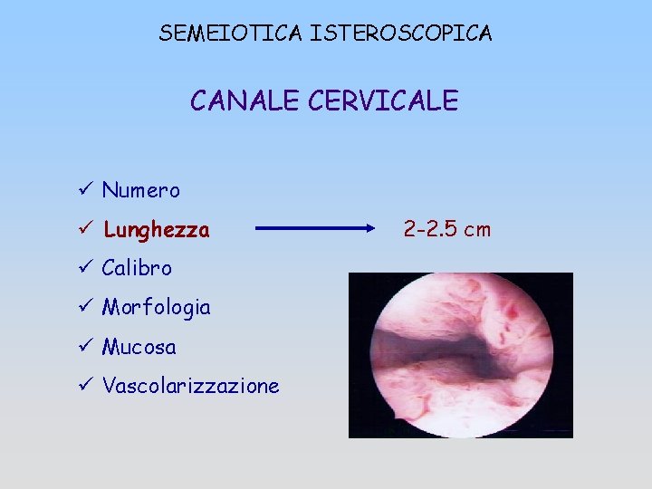 SEMEIOTICA ISTEROSCOPICA CANALE CERVICALE ü Numero ü Lunghezza ü Calibro ü Morfologia ü Mucosa
