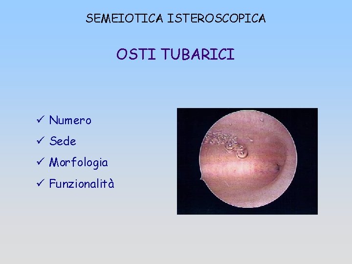 SEMEIOTICA ISTEROSCOPICA OSTI TUBARICI ü Numero ü Sede ü Morfologia ü Funzionalità 