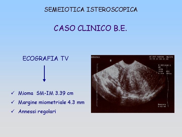 SEMEIOTICA ISTEROSCOPICA CASO CLINICO B. E. ECOGRAFIA TV ü Mioma SM-IM 3. 39 cm