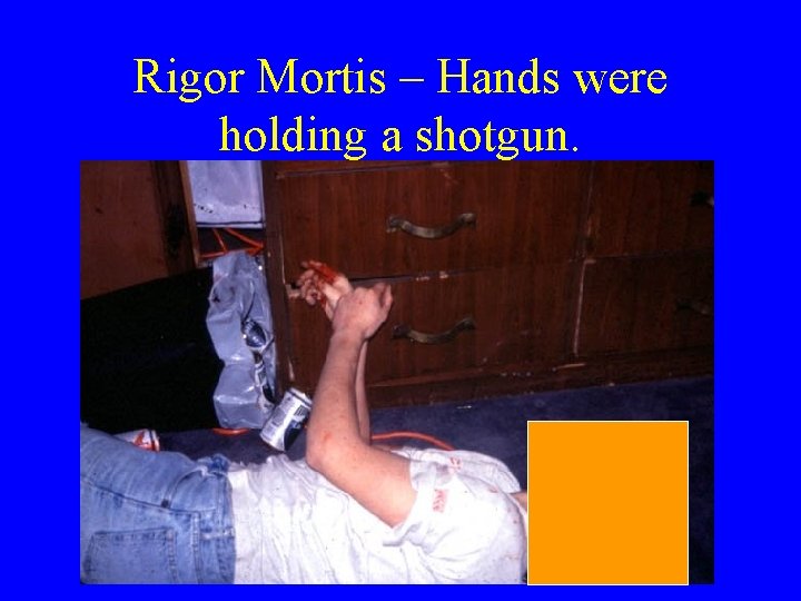 Rigor Mortis – Hands were holding a shotgun. Rigor Mortis – Hands were holding a shotgun.