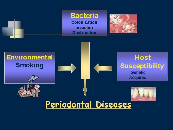 Bacteria Colonisation Invasion Destruction Environmental Smoking Host Susceptibility Genetic Acquired Periodontal Diseases 