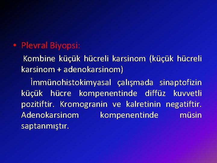  • Plevral Biyopsi: Kombine küçük hücreli karsinom (küçük hücreli karsinom + adenokarsinom) İmmünohistokimyasal