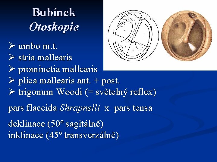 Bubínek Otoskopie Ø umbo m. t. Ø stria mallearis Ø prominetia mallearis Ø plica