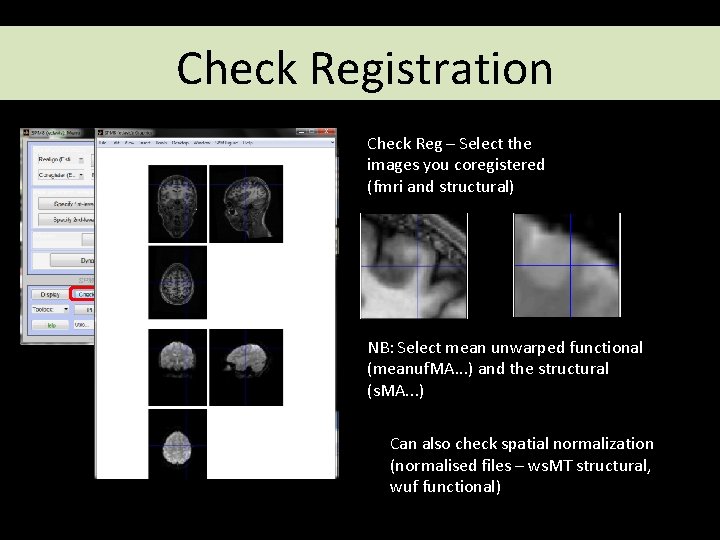 Check Registration Check Reg – Select the images you coregistered (fmri and structural) NB: