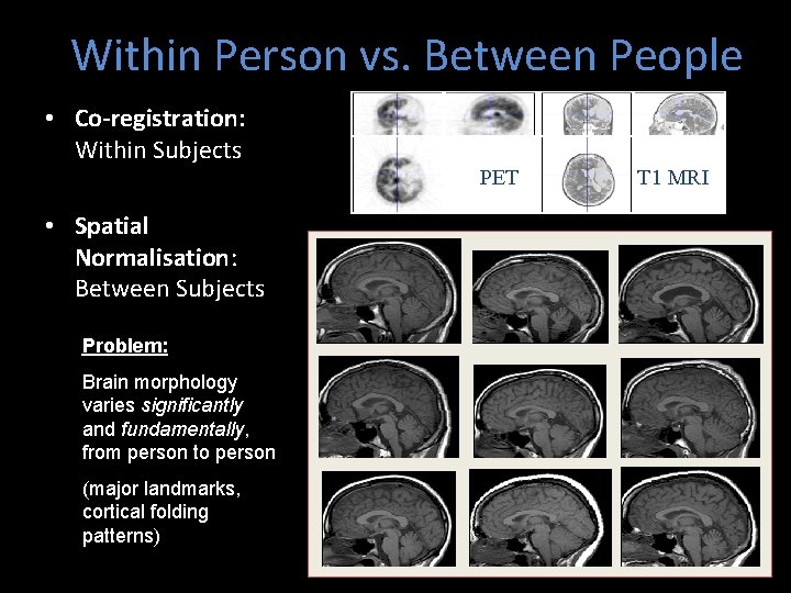 Within Person vs. Between People • Co-registration: Within Subjects PET • Spatial Normalisation: Between