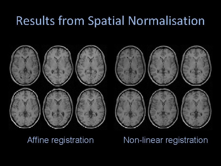 Results from Spatial Normalisation Affine registration Non-linear registration 