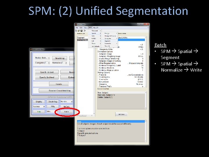 SPM: (2) Unified Segmentation Batch • SPM Spatial Segment • SPM Spatial Normalize Write
