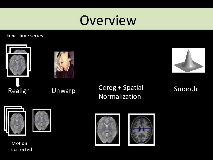 Overview Func. time series Realign Motion corrected Unwarp Coreg + Spatial Normalization Smooth 