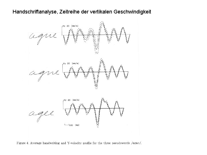 Handschriftanalyse, Zeitreihe der vertikalen Geschwindigkeit 