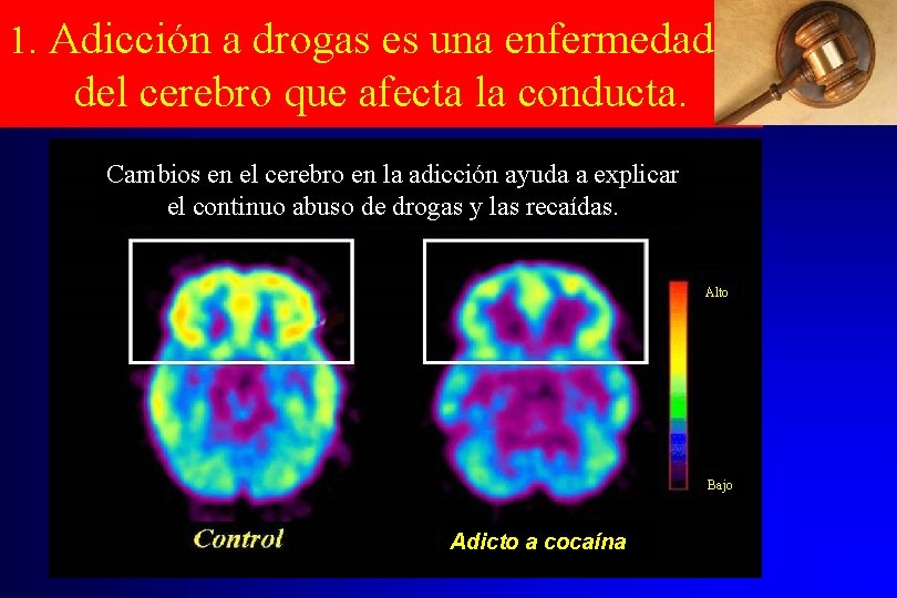 1. Adicción a drogas es una enfermedad del cerebro que afecta la conducta. Cambios