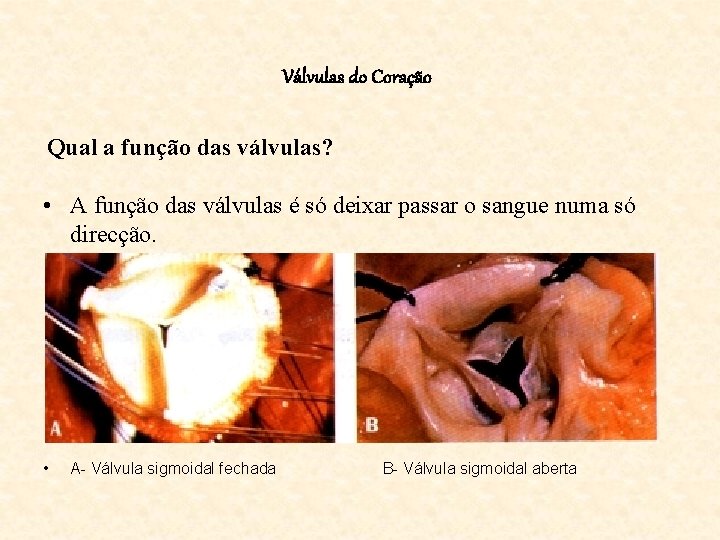 Válvulas do Coração Qual a função das válvulas? • A função das válvulas é