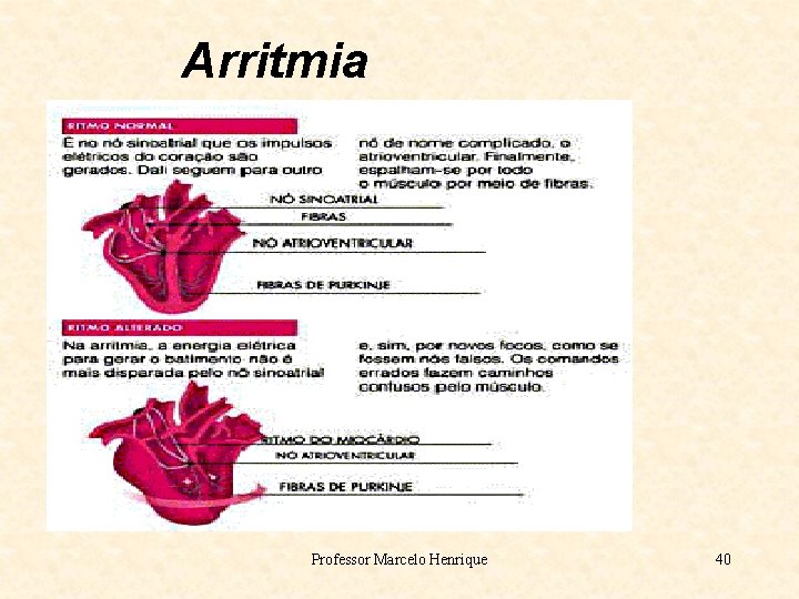 Arritmia Professor Marcelo Henrique 40 