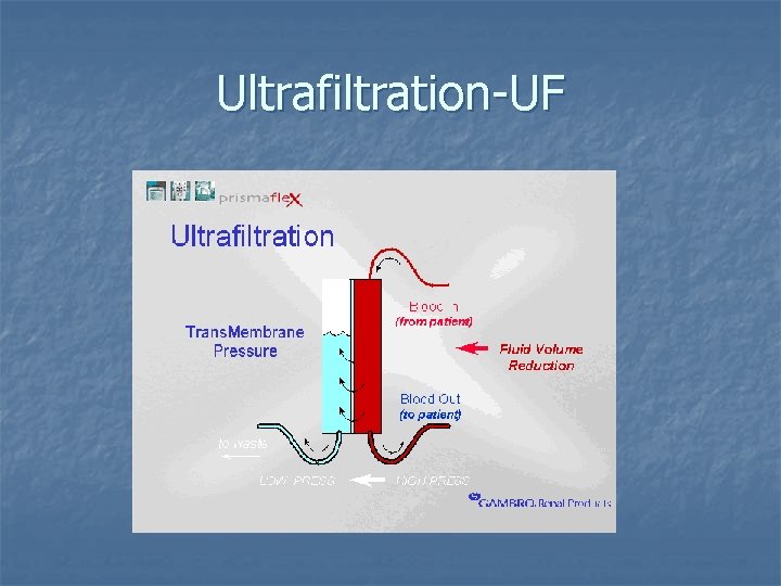 Ultrafiltration-UF 