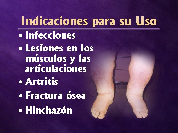 Indicaciones para su Uso • Infecciones • Lesiones en los músculos y las articulaciones